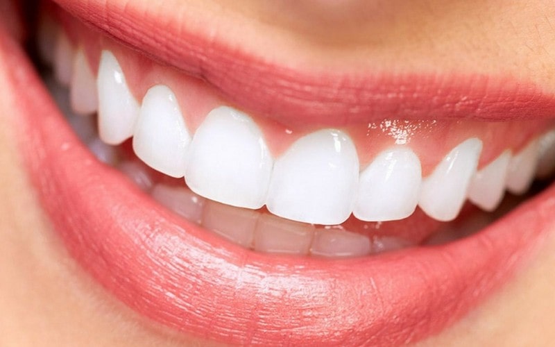Tratamiento de estetica dental en pilar Smiling Pilar